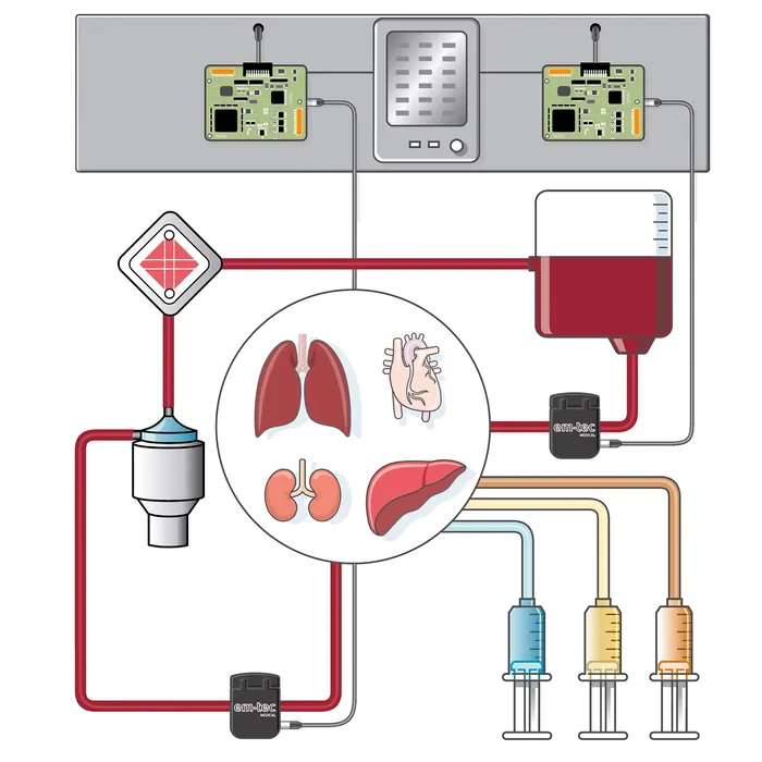 Hemodialysis machine with blood circuit and organs illustration