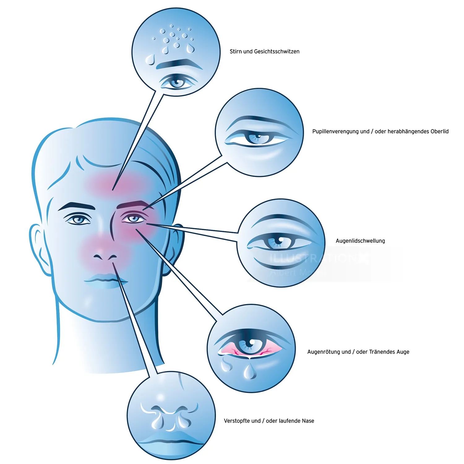 Diagram of facial symptoms affecting eyes, nose, and skin areas