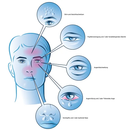 Diagram of facial symptoms affecting eyes, nose, and skin areas