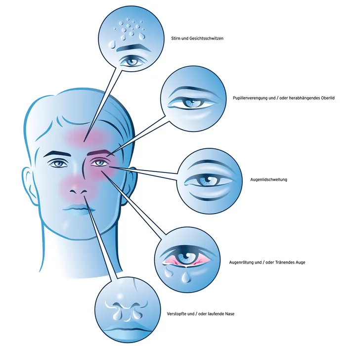 Diagram of facial symptoms affecting eyes, nose, and skin areas