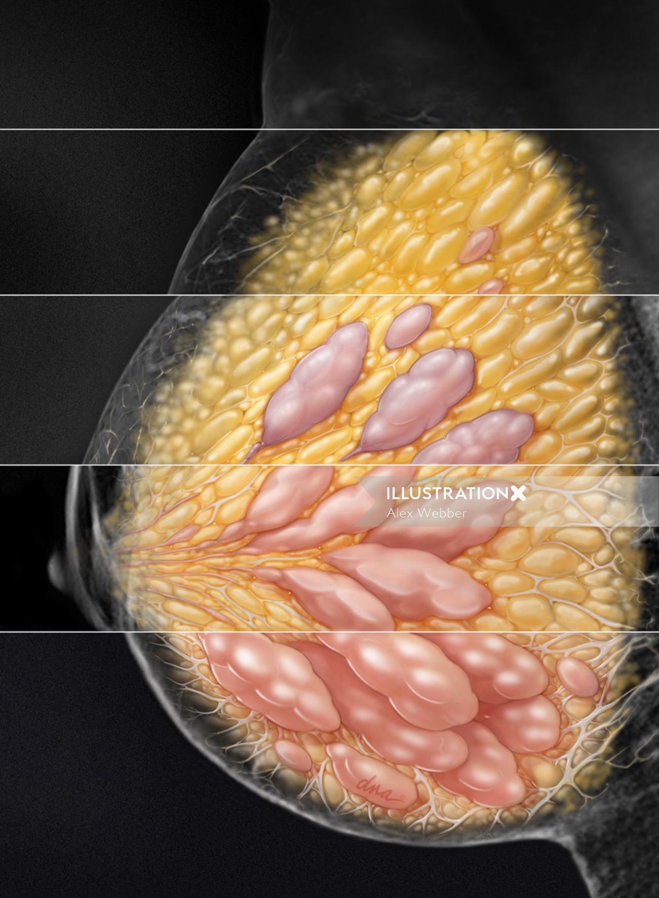 Imagem natural em 4 graus de densidade mamária em mamografia