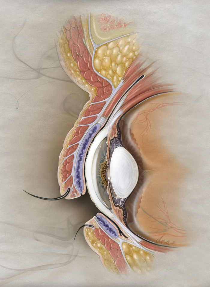 Dry eye section realistic image