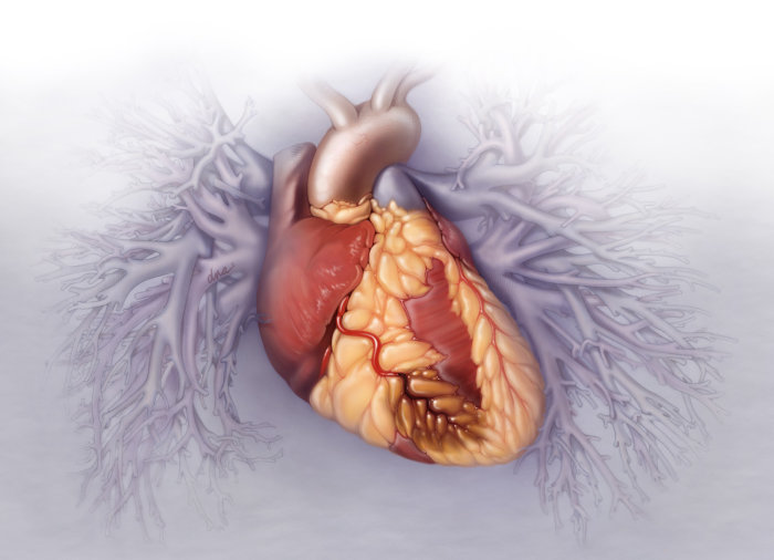 冠動脈疾患のフォトリアリズム