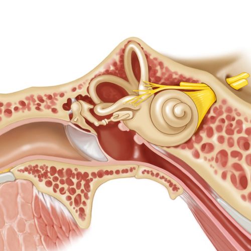 Medical illustration of Swimmer's Ear