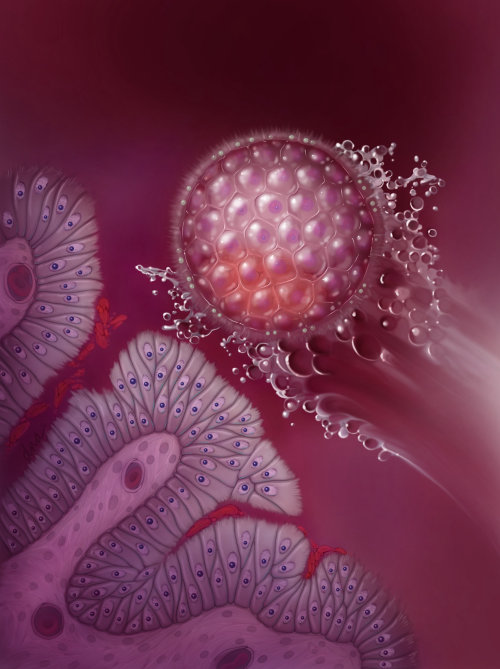 IVF Blastocyst Transfer medical illustration 