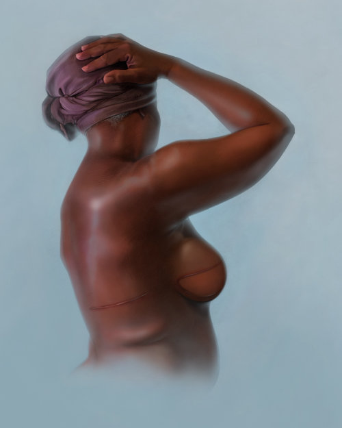 Photorealistic breast cancer survivor