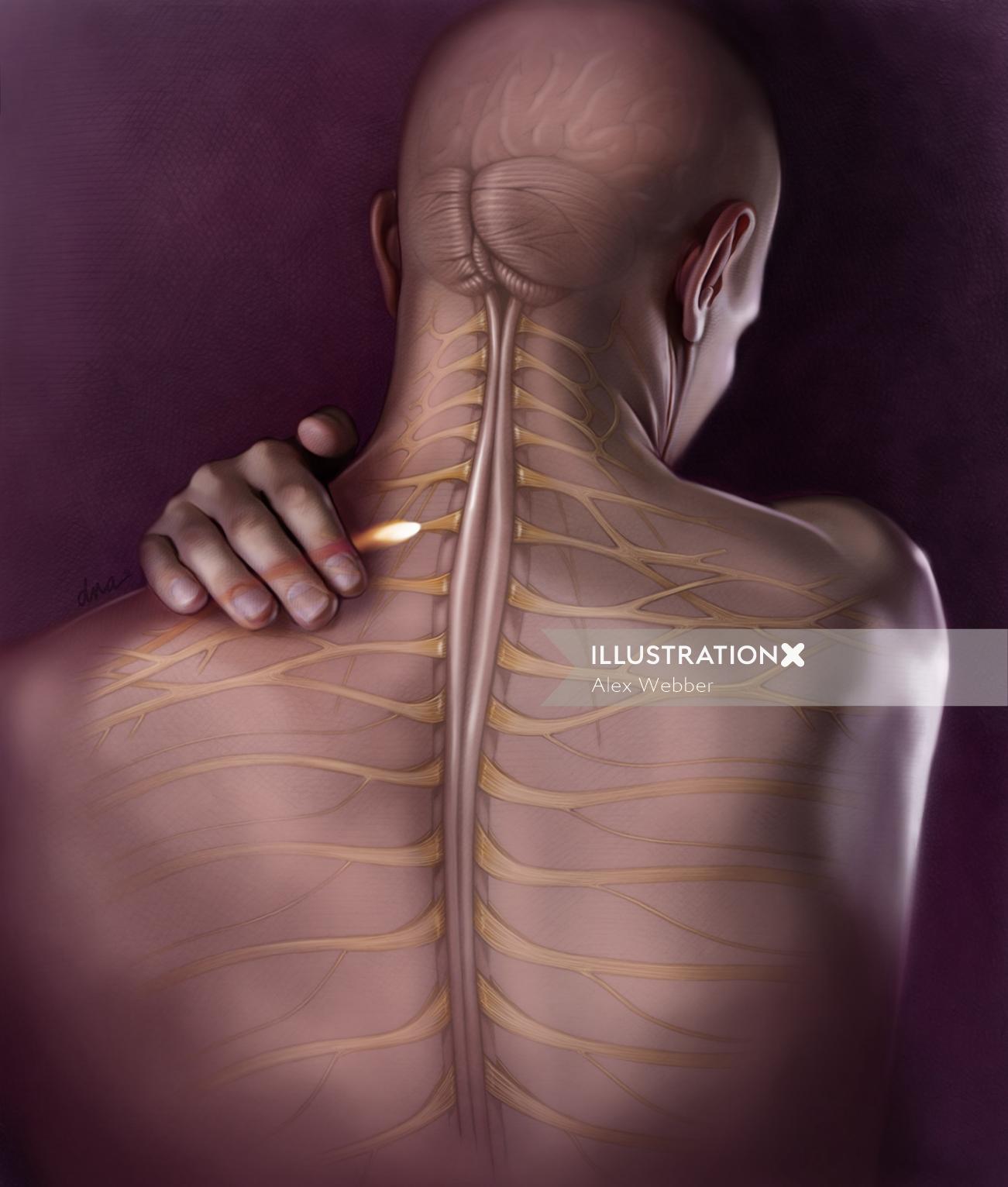 Ilustração médica para dor nas costas