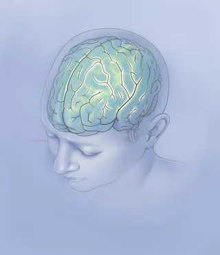 Migraine advertising image for pharmaceutical industry