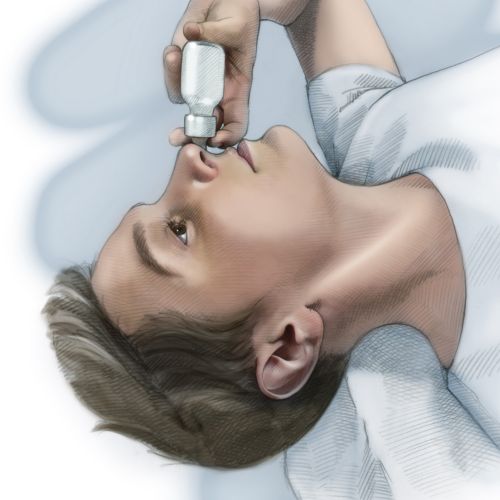 Educational illustration on how to use nasal spray