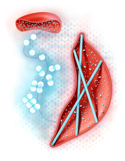 Editorial cover image showing Sickle-cell disease