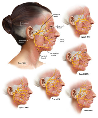 Ilustración del nervio facial
