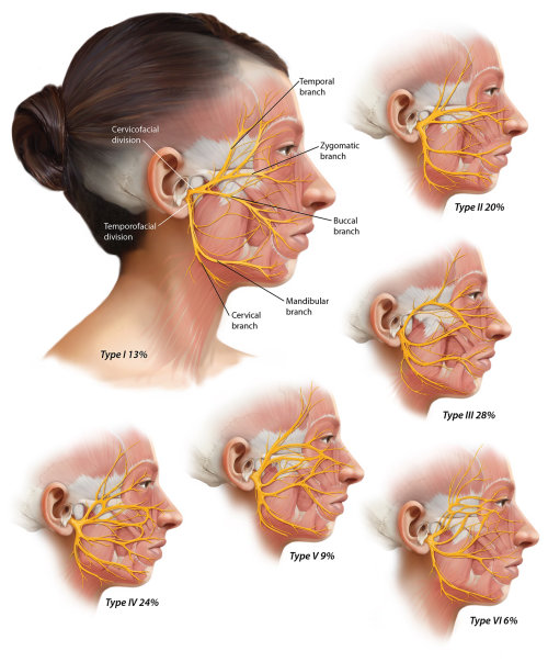 Depicting the six common branching patterns of the facial nerve
