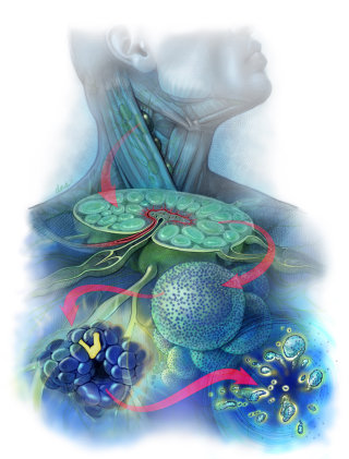 Arte conceptual del linfoma folicular.