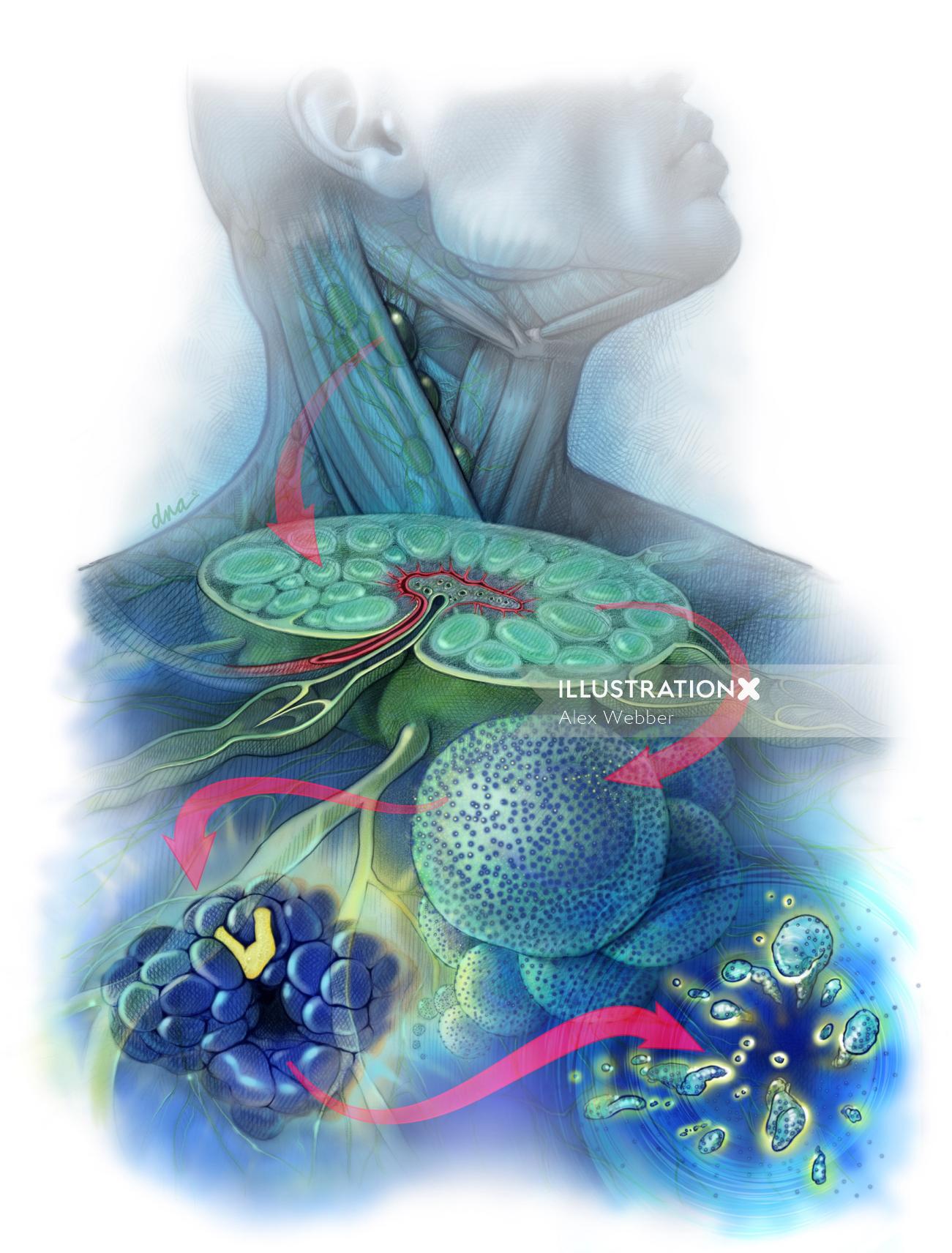 濾胞性リンパ腫のコンセプトアート
