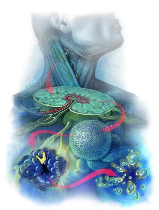 Concept art of Follicular lymphoma