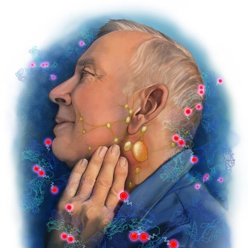 Educational illustration about treatment of non-Hodgkin lymphoma