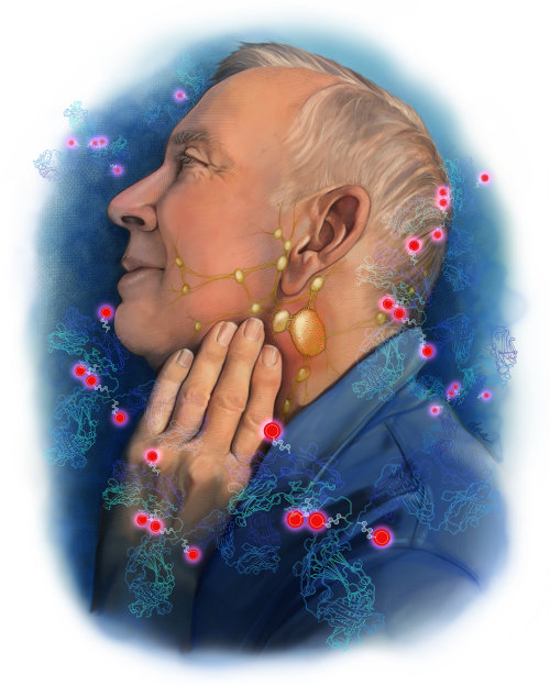 Educational illustration about treatment of non-Hodgkin lymphoma