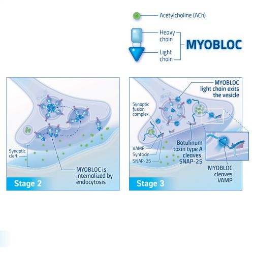 Myobloc drug mechanism of action illustration