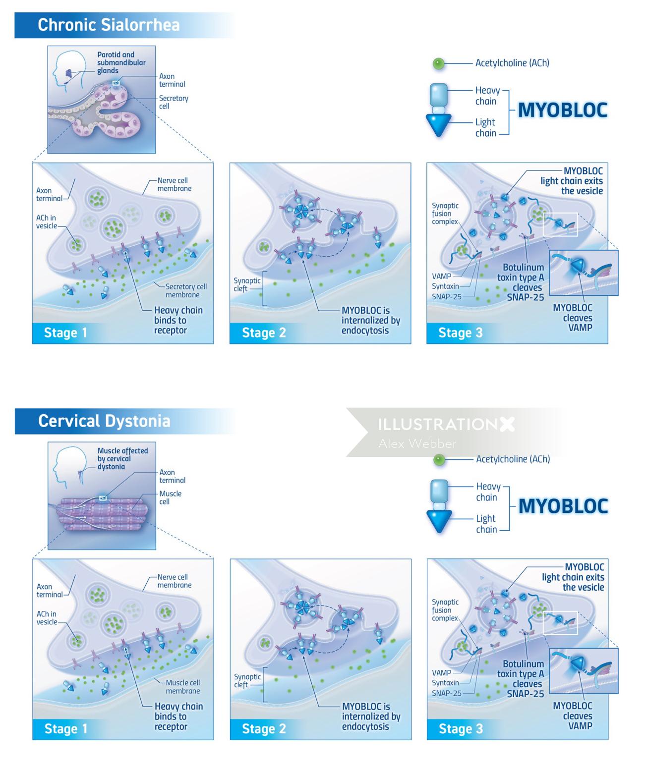Ilustração do mecanismo de ação da droga Myobloc