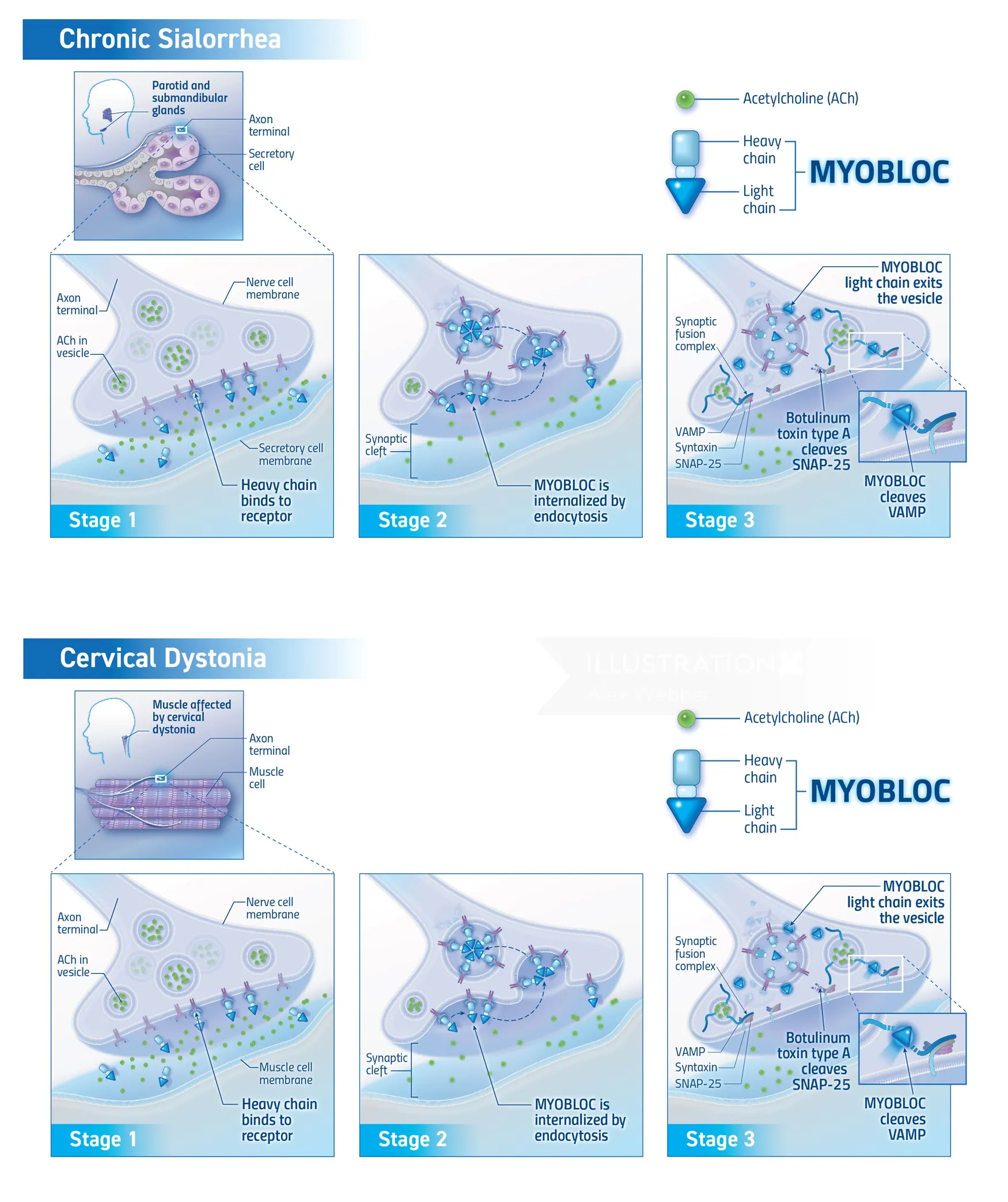 Myobloc drug mechanism of action illustration