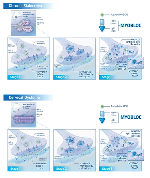 Myobloc drug mechanism of action illustration