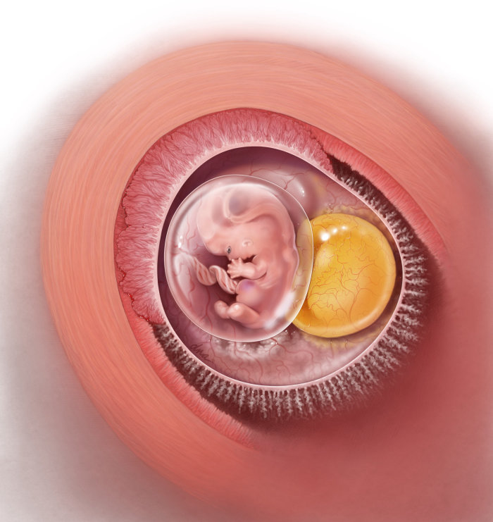 Illustration showing 7 week abnormal yolk sign