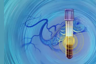 Test tube with yellow liquid over blue veins by Alex Webber