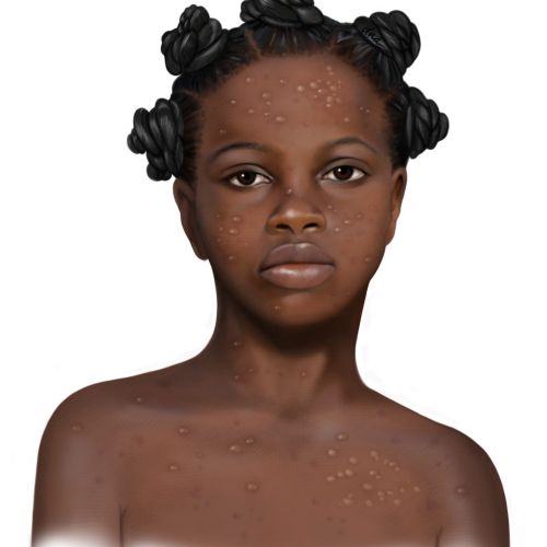 Alex Webber Medical illustrator. USA