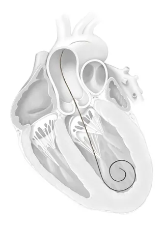 Cross-section of the human heart anatomy by Alex Webber