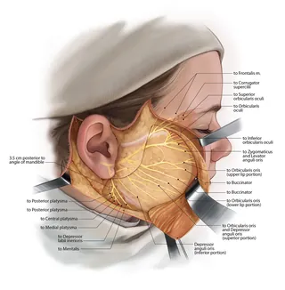 Facial nerve anatomy illustration showing labeled muscles and nerve branches by Alex Webber