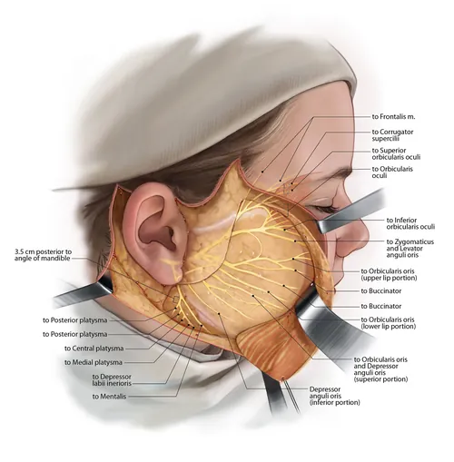 Facial nerve anatomy illustration showing labeled muscles and nerve branches by Alex Webber