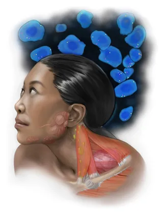 Anatomical illustration of neck muscles and tissues with person's profile by Alex Webber
