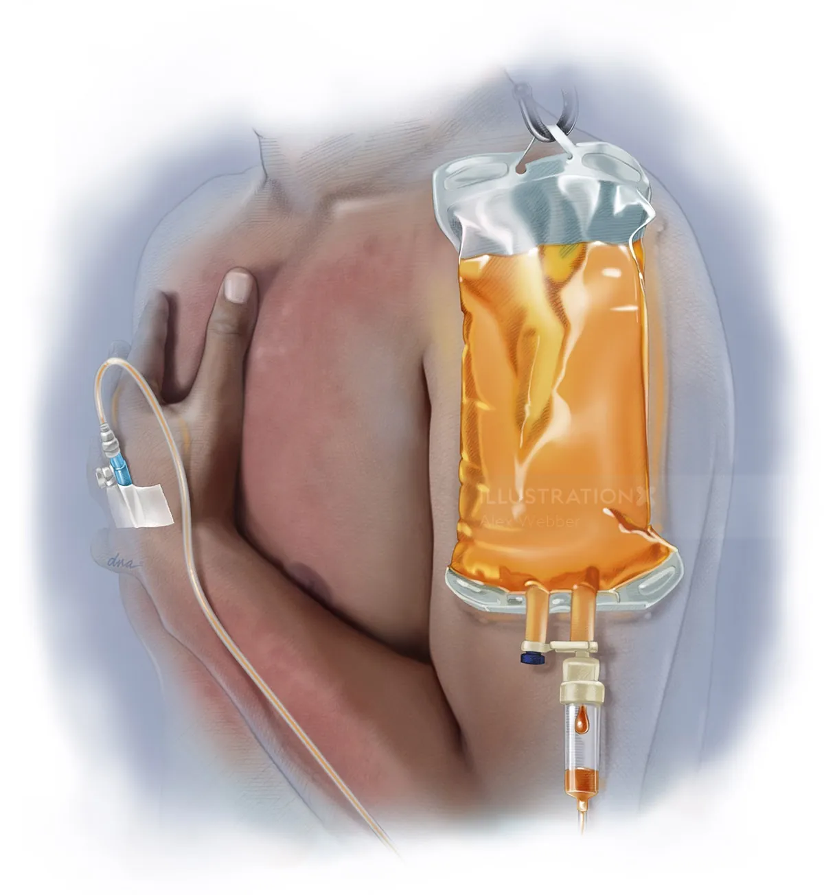 Human arm receiving IV fluid through medical tubing