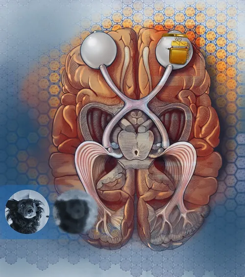 Surreal brain illustration with mechanical and organic elements by Alex Webber