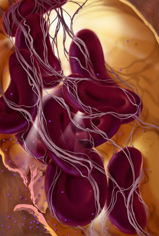毛細血管の慢性炎症の内部観察