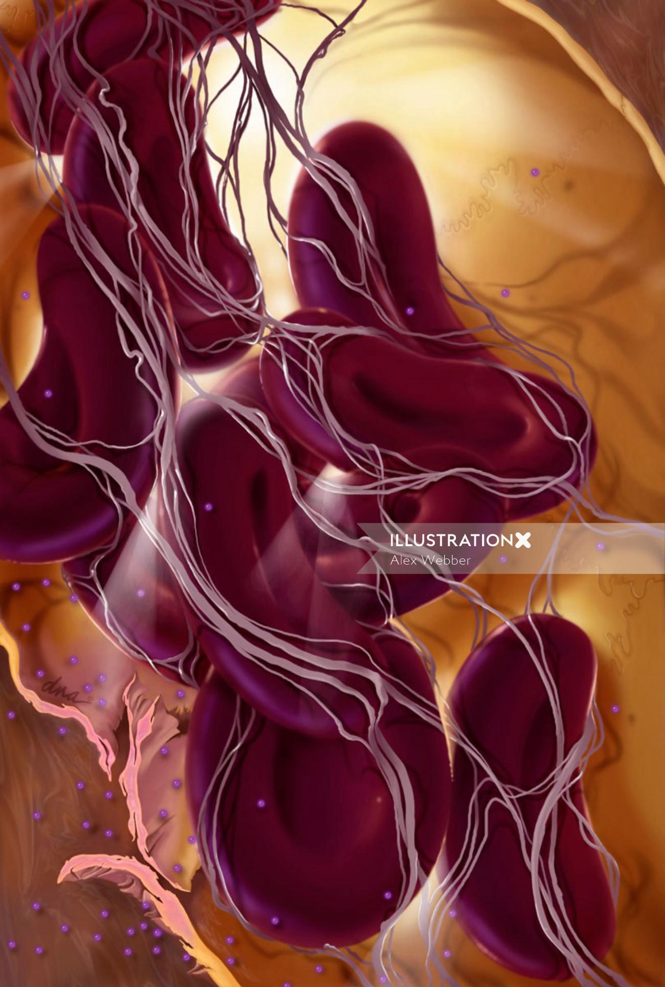 Internal view of a chronic inflammation on capillary
