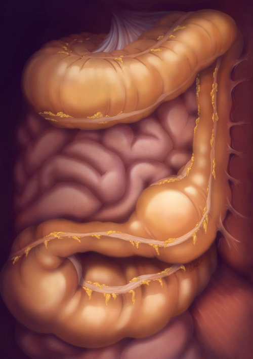 Constipation in large intestine illustration by AlexBaker
