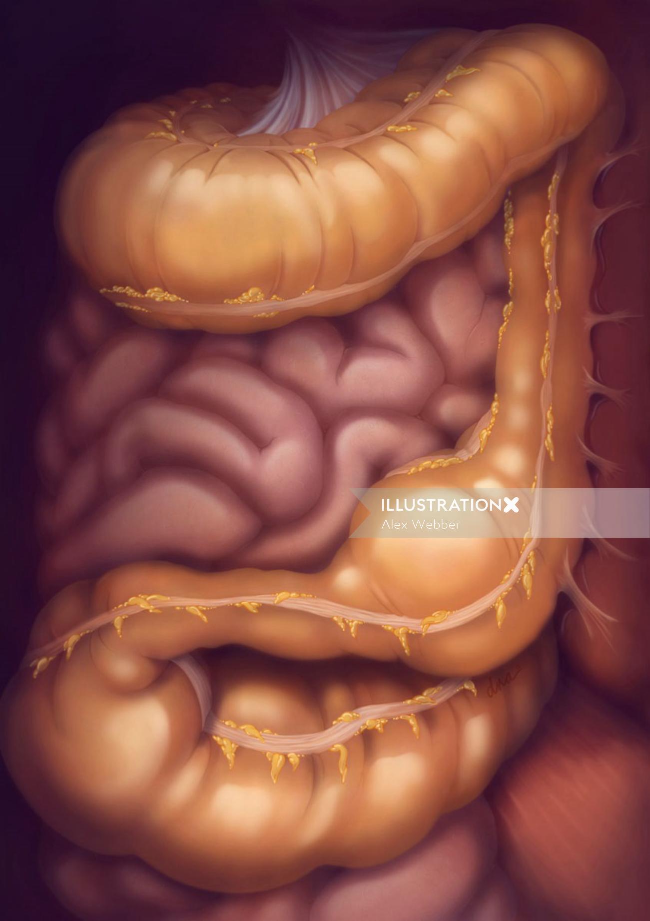 Constipação na ilustração do intestino grosso por AlexBaker