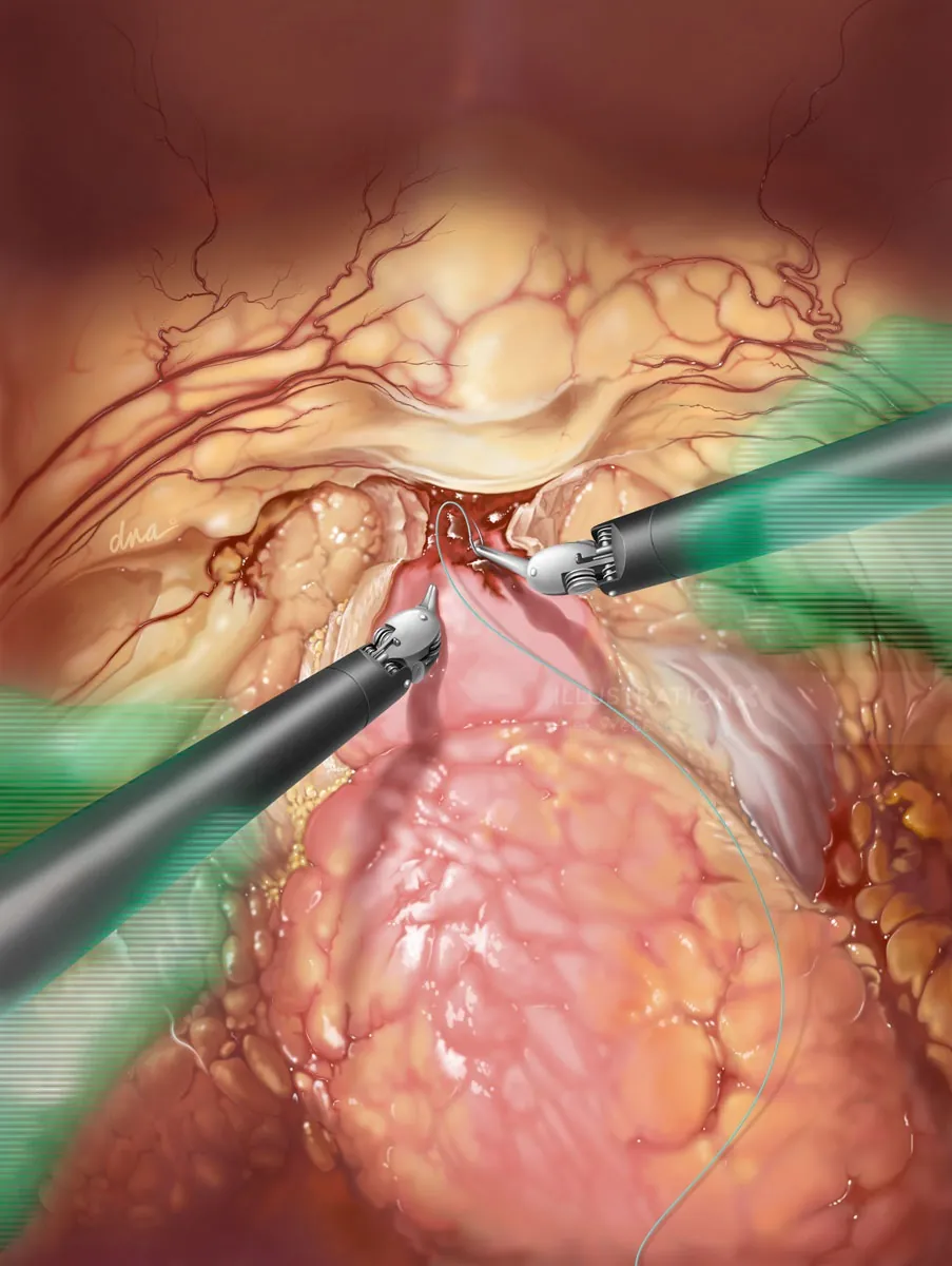 Surgeon in control depicted with robotic surgical hologram