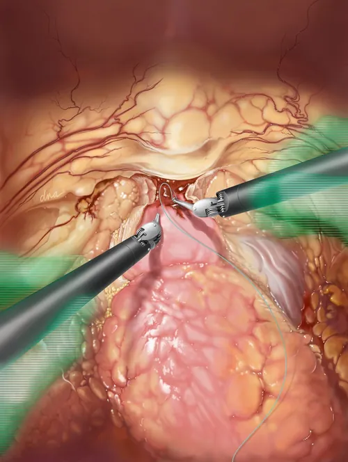 Surgeon in control depicted with robotic surgical hologram