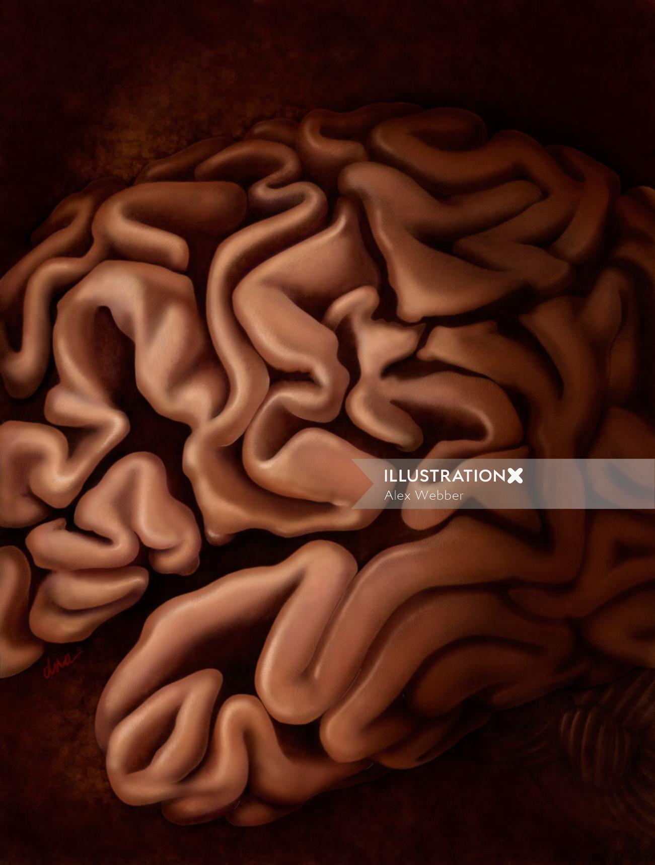 Vista lateral da síndrome de Alzheimer