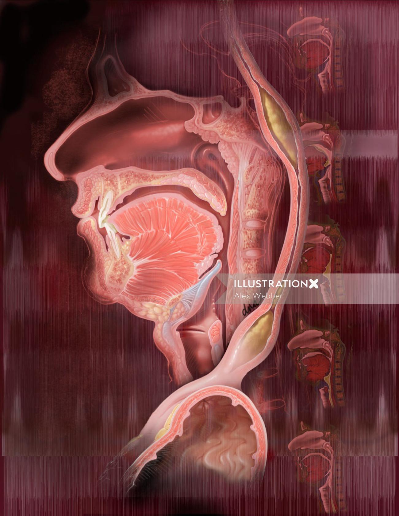 Illustration de la dysphagie et de la déglutition par AlexBaker