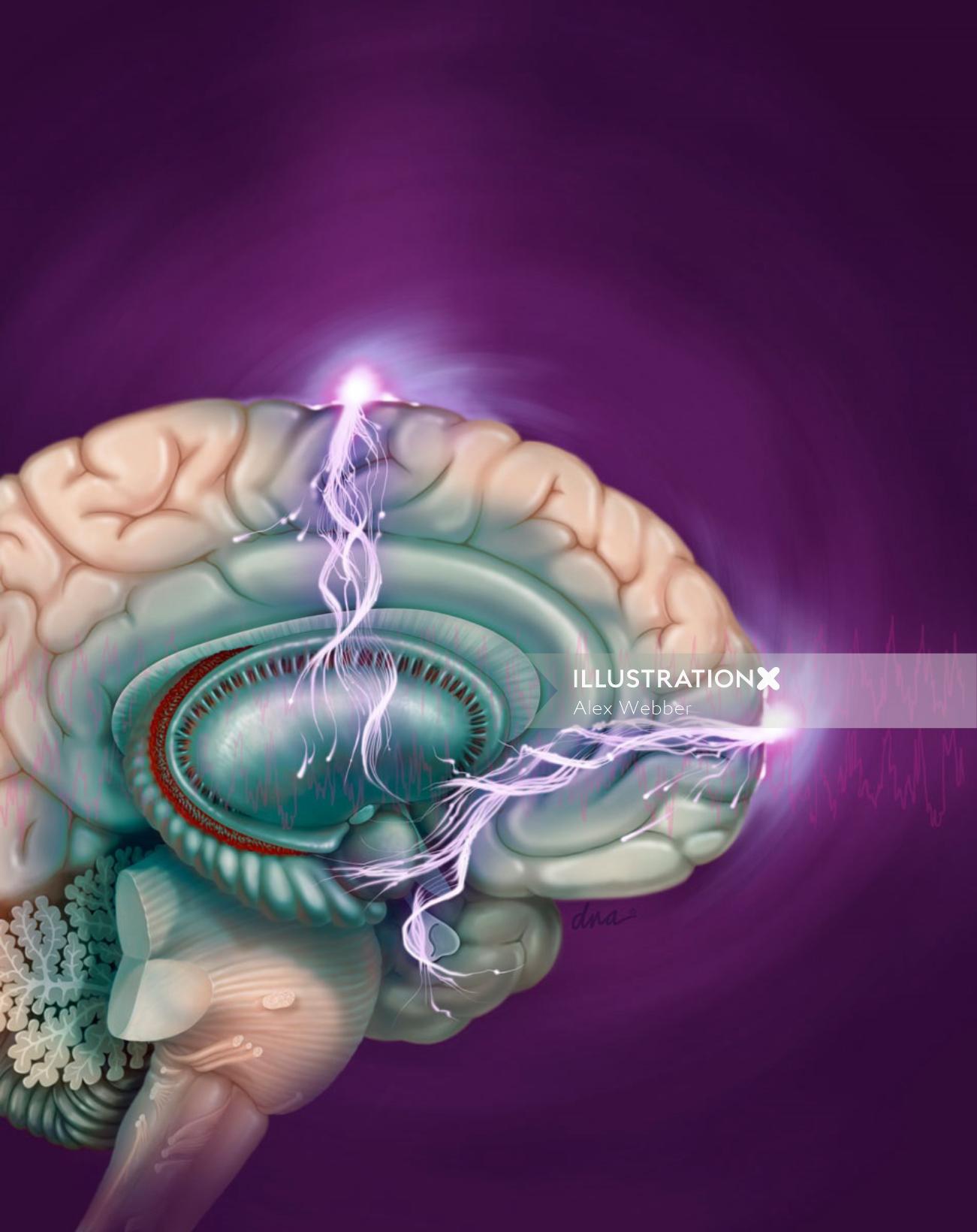 Illustration de la thérapie électroconvulsive par AlexBaker