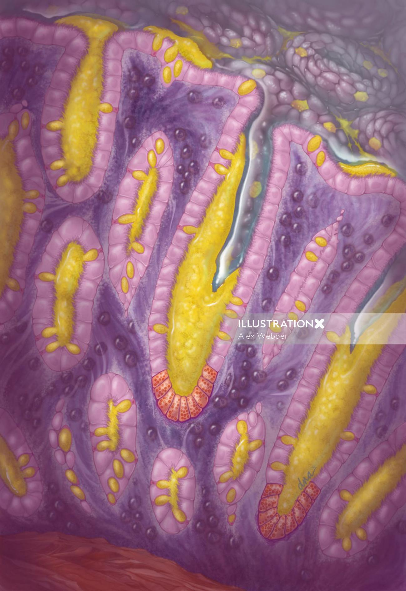 Arte realista da histologia do intestino grosso mostrando mucosite