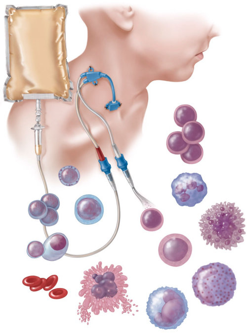 Informative of Hematopoietic Stem Cell Transplant