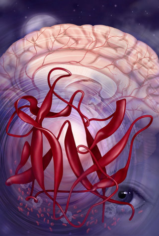 Illustration conceptuelle des cytokines proinflammatoires chez les patients cancéreux