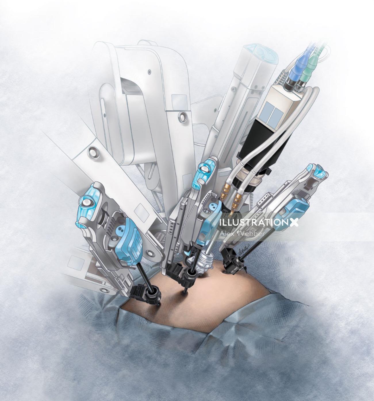 Ilustração de cirurgia robótica por AlexBaker