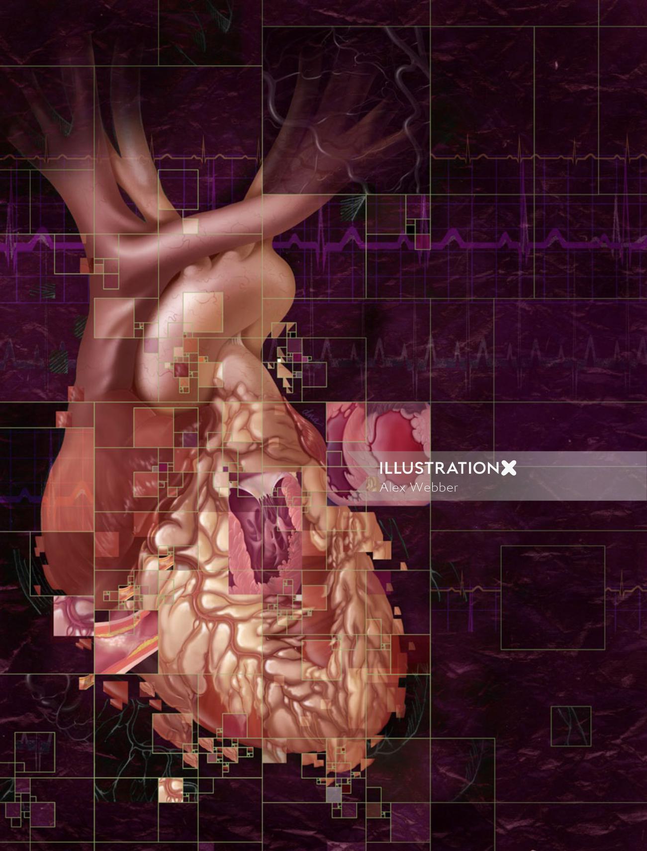 Ilustração de baixa ejeção ventricular de AlexBaker