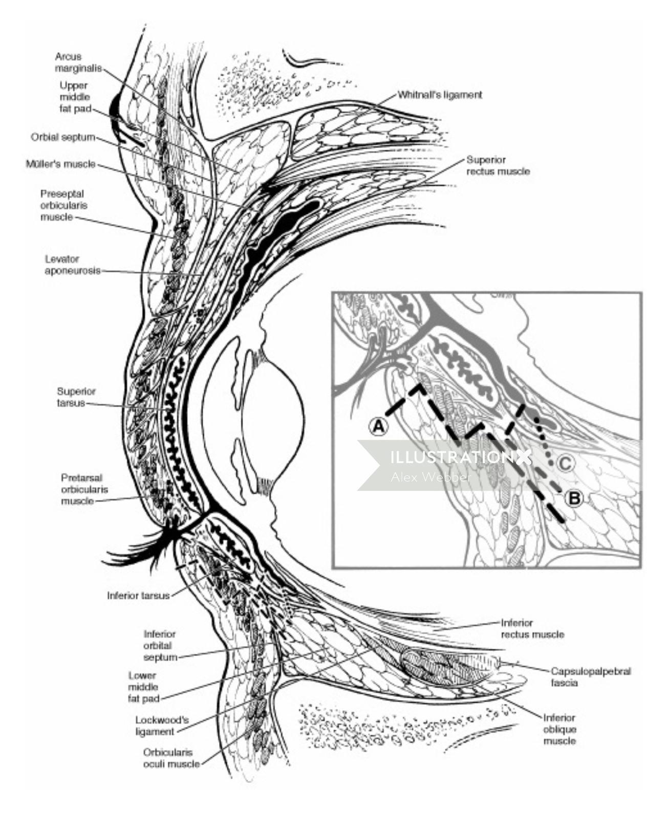 Desenho da anatomia da cirurgia das pálpebras