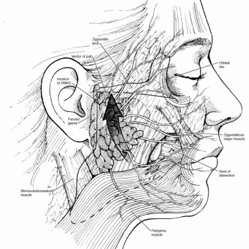 Medical illustration of face layers 